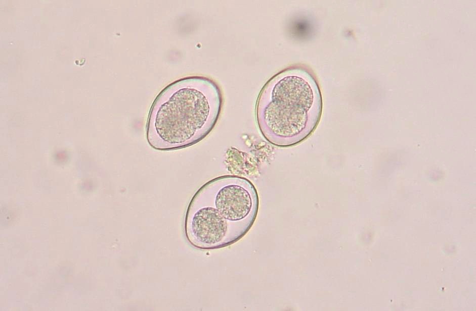 Cocidia oocyst in a fecal float